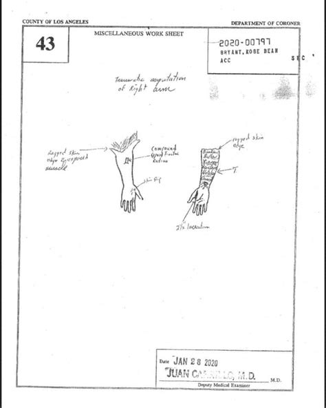 gigis autopsy report|Kobe Bryant Autopsy Report